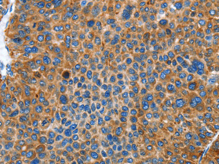 AUP1 Polyclonal Antibody Store at -20°C