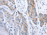 NDUFA12 Polyclonal Antibody Store at -20°C