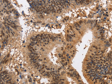 KCNG2 Polyclonal Antibody Store at -20°C