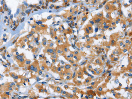 CD244 Polyclonal Antibody Store at -20°C
