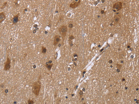 c-Rel Polyclonal Antibody Store at -20°C