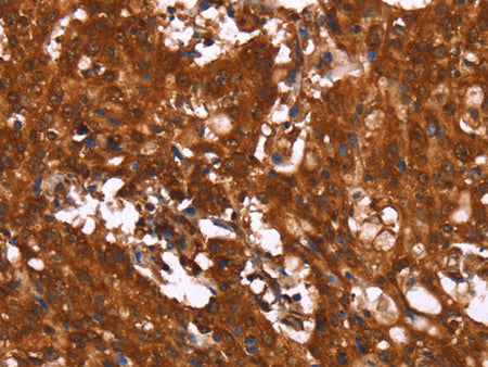 HCAR2 Polyclonal Antibody Store at -20°C