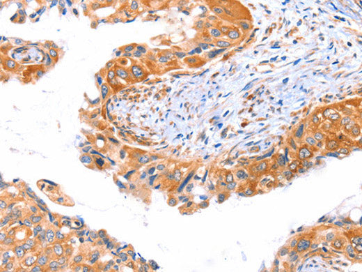 AP1B1 Polyclonal Antibody Host Rabbit