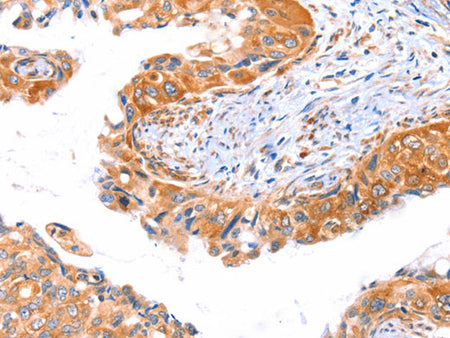 AP1B1 Polyclonal Antibody Host Rabbit
