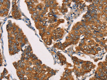 SPR Polyclonal Antibody Store at -20°C