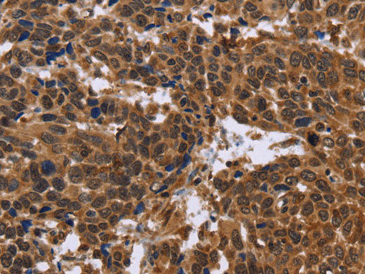 EDN2 Polyclonal Antibody Reactivity Human