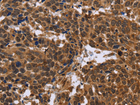 EDN2 Polyclonal Antibody Reactivity Human