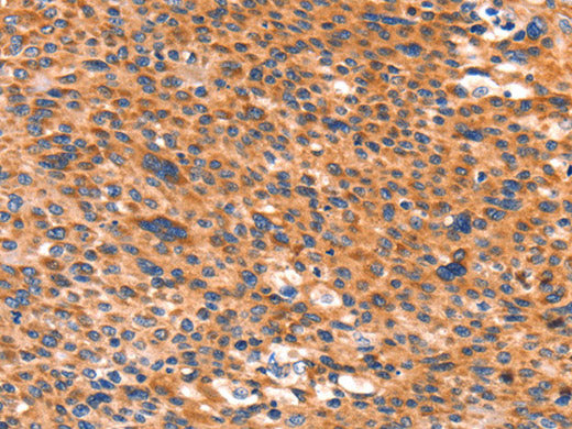 AMPD1 Polyclonal Antibody Store at -20°C