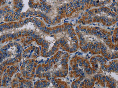 P3H3 Polyclonal Antibody Store at -20°C