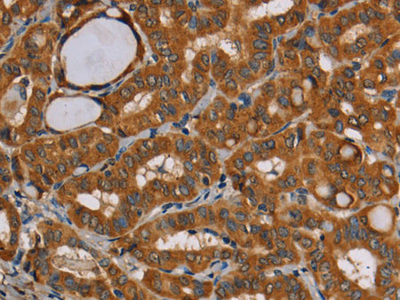 CENPU Polyclonal Antibody