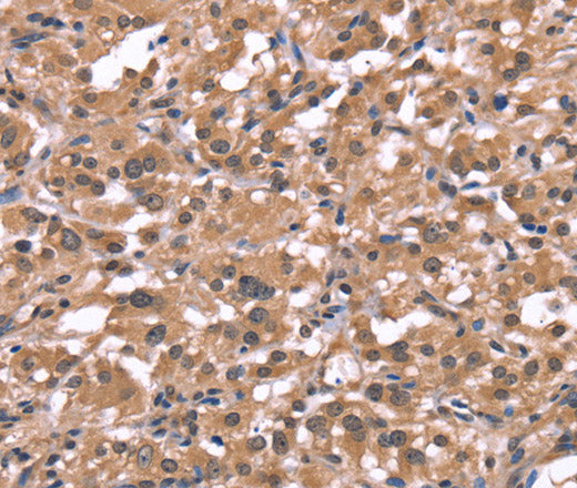 Histamine H1 Receptor Polyclonal Antibody