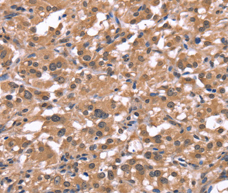 Histamine H1 Receptor Polyclonal Antibody