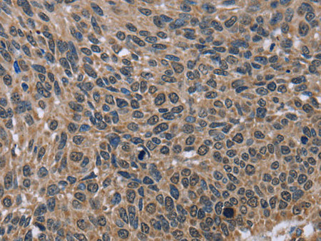 IMPDH2 Polyclonal Antibody Store at -20°C