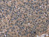 IMPDH2 Polyclonal Antibody Store at -20°C