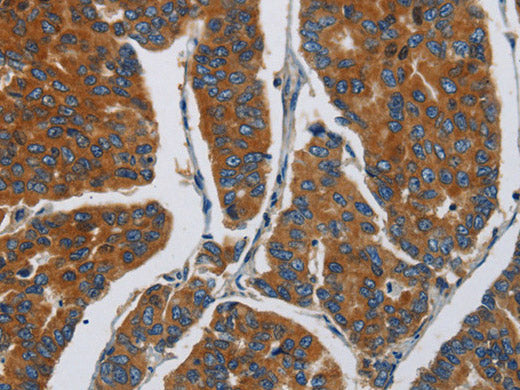 APEH Polyclonal Antibody Store at -20°C