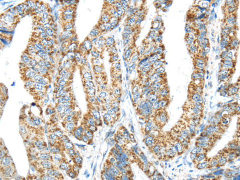 IFNA2 Polyclonal Antibody Store at -20°C