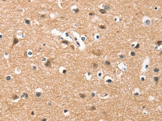HDAC8 Polyclonal Antibody Store at -20°C