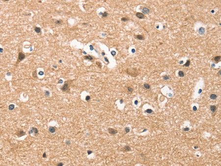 HDAC8 Polyclonal Antibody Store at -20°C
