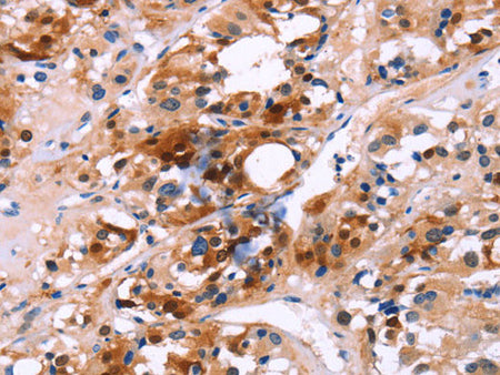 CALB1 Polyclonal Antibody Store at -20°C