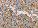 KIF17 Polyclonal Antibody