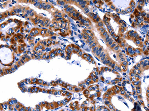 FBN1 Polyclonal Antibody Store at -20°C