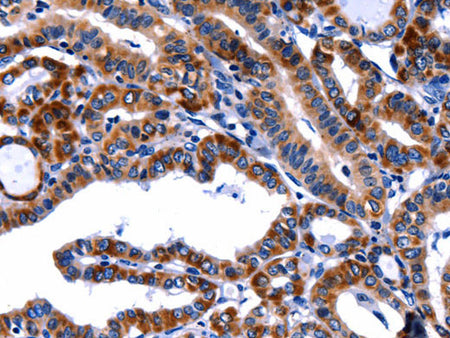 FBN1 Polyclonal Antibody Store at -20°C