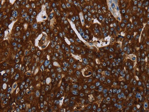 KISS1R Polyclonal Antibody Store at -20°C
