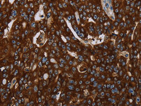 KISS1R Polyclonal Antibody Store at -20°C