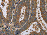 HSP40-4 Polyclonal Antibody Store at -20°C