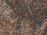 HOMER2 Polyclonal Antibody Store at -20°C