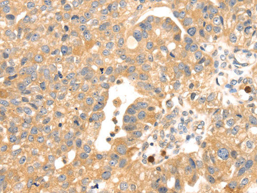 S100A12 Polyclonal Antibody Store at -20°C