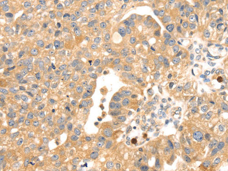 S100A12 Polyclonal Antibody Store at -20°C