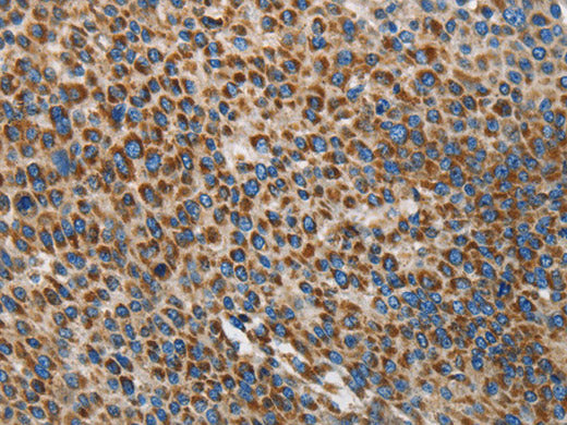 UPF1 Polyclonal Antibody Store at -20°C