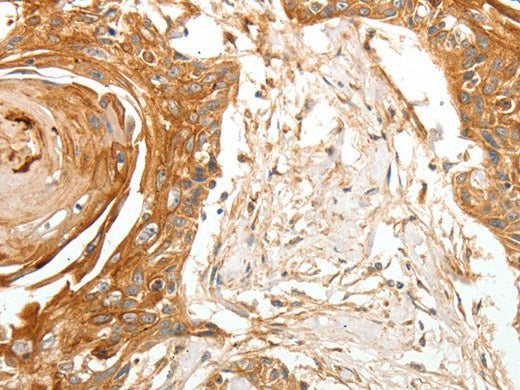 TERT Polyclonal Antibody Store at -20°C