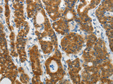 PRDX5 Polyclonal Antibody