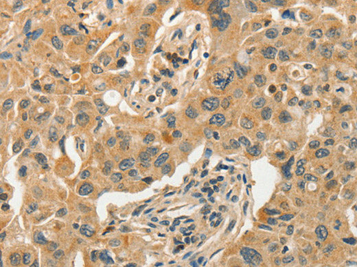 SLC11A2 Polyclonal Antibody Store at -20°C