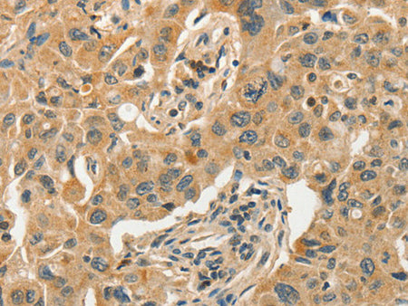 SLC11A2 Polyclonal Antibody Store at -20°C