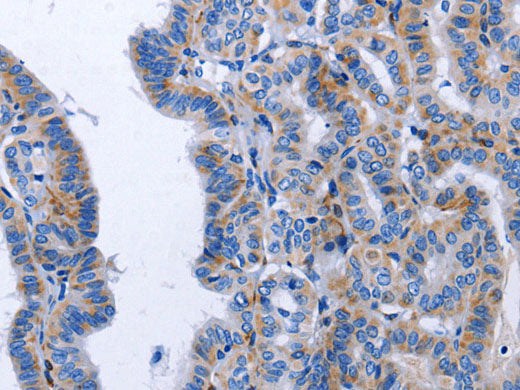 BDNF Polyclonal Antibody Store at -20°C