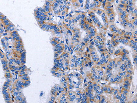 BDNF Polyclonal Antibody Store at -20°C