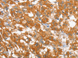 WNT3A Polyclonal Antibody Store at -20°C - MSE Supplies LLC