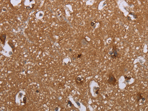 LIMK1 Polyclonal Antibody Store at -20°C