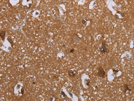 LIMK1 Polyclonal Antibody Store at -20°C