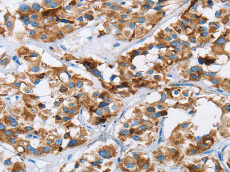 HINT2 Polyclonal Antibody Store at -20°C