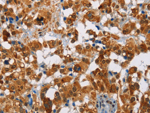 ATXN1 Polyclonal Antibody Store at -20°C
