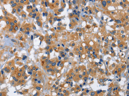 IL2RB Polyclonal Antibody Store at -20°C