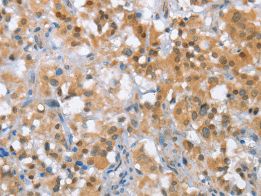 MLH1 Polyclonal Antibody Store at -20°C