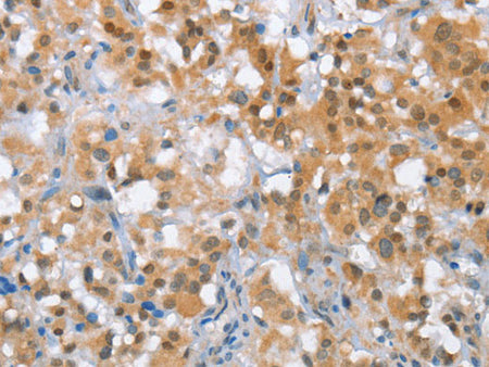 MLH1 Polyclonal Antibody Store at -20°C