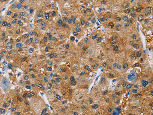 NCR3 Polyclonal Antibody Store at -20°C