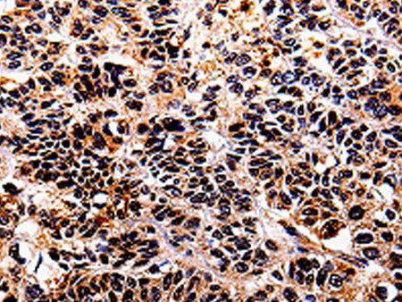 IL10RA Polyclonal Antibody Store at -20°C