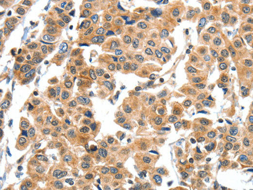 XBP1 Polyclonal Antibody Store at -20°C